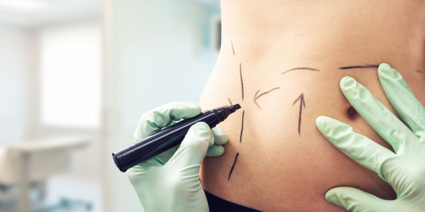 Cirurgia Plástica